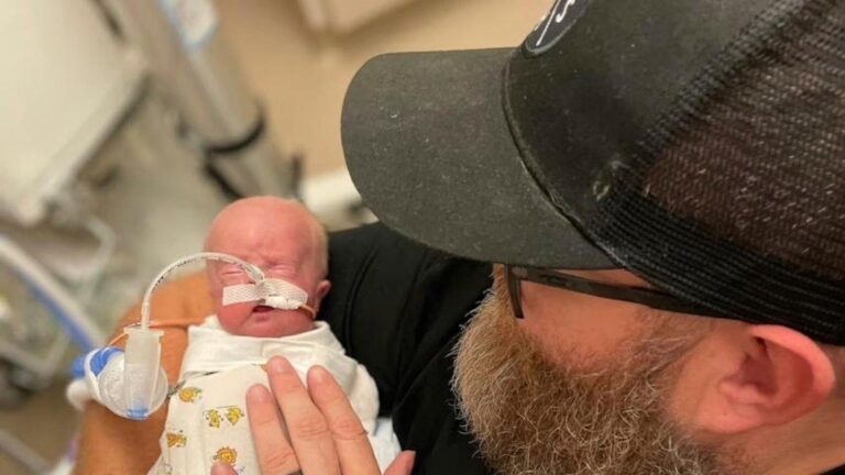 Most premature baby celebrates his 1st birthday with a Guinness World Record