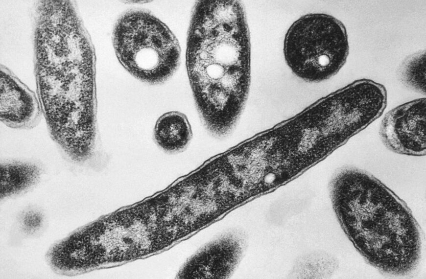 Death toll from Legionnaires’ disease outbreak in New York City rises to 6 and infections hit 111