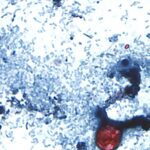 Taylor Farms recalls lettuce shipped to 27 states over cyclospora risk