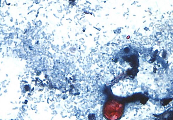 Taylor Farms recalls lettuce shipped to 27 states over cyclospora risk