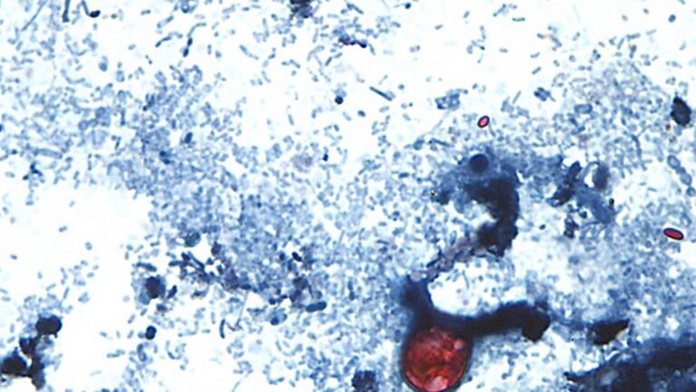 Taylor Farms recalls lettuce shipped to 27 states over cyclospora risk